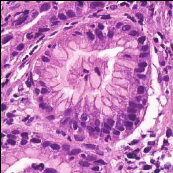 Normal gastric gland at 20x magnification, H&E