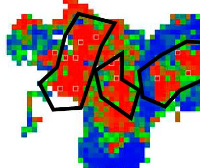 DeepPATHO ALK-probability heatmap over a lung resection slide
